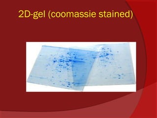 2D-gel (coomassie stained)

 