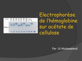 Par :S/Abdessemed
Electrophorèse
de l’hémoglobine
sur acétate de
cellulose
 