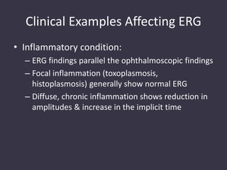 Clinical Examples Affecting ERG
• Inflammatory condition:
– ERG findings parallel the ophthalmoscopic findings
– Focal inflammation (toxoplasmosis,
histoplasmosis) generally show normal ERG
– Diffuse, chronic inflammation shows reduction in
amplitudes & increase in the implicit time
 