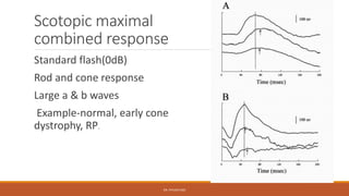 Maxamil Rp Electrophysiological tests of retina | PPTX