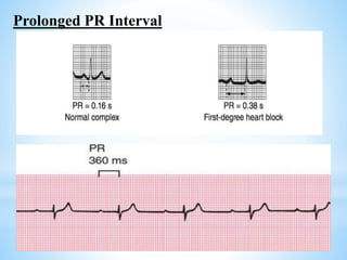 Electrophysiology of heart | PPTX