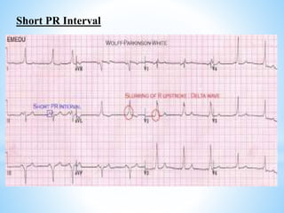 Short Pri Electrophysiology of heart | PPTX