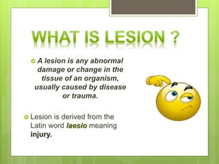 lower motor neuron lesion (LMNL) Slide 13