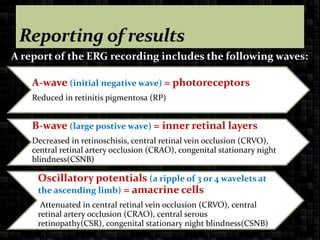 ELECTRORETINOGRAPHY (in veterinary).pptx