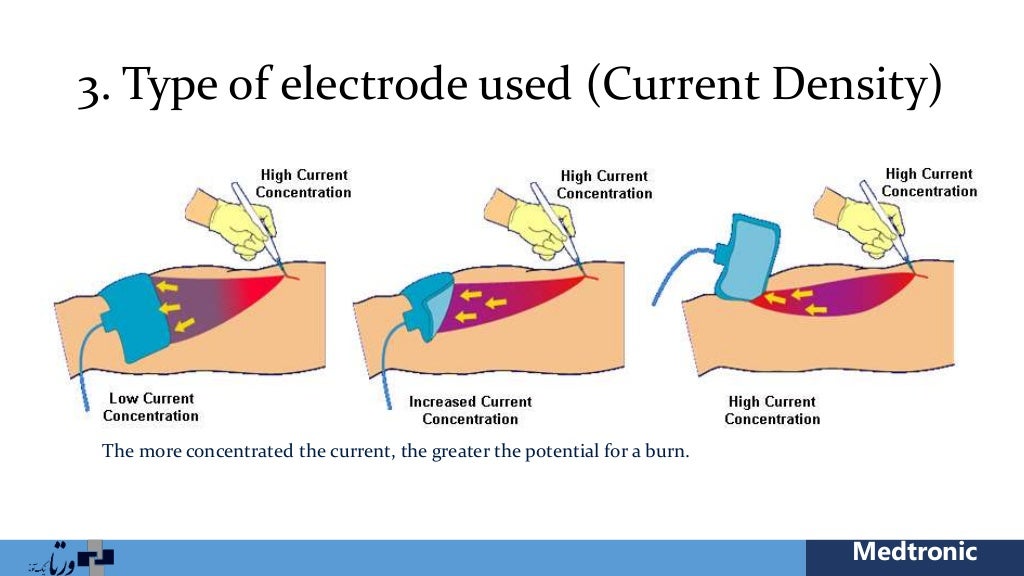 Electrosurgery