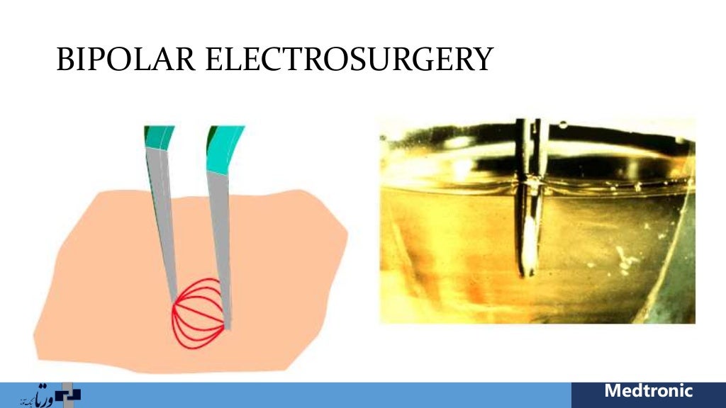 Electrosurgery
