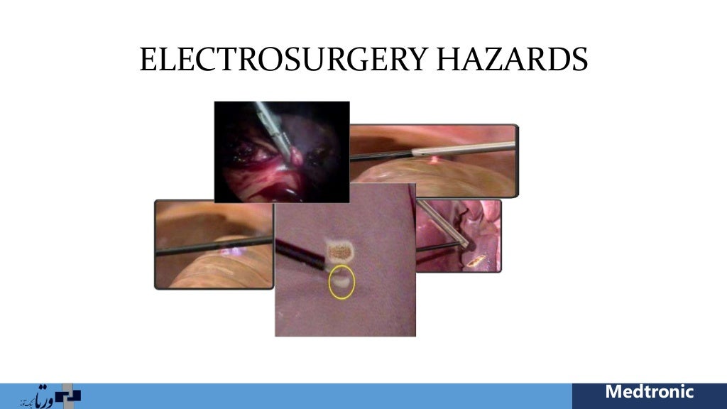 Electrosurgery