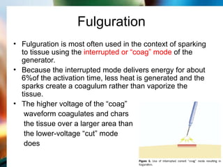 Fulgurated Basic about electrosurgery and its properties.ppt