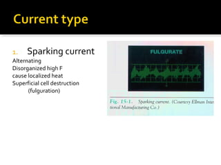Fulgurated Electro surgery in dental practice | PPT