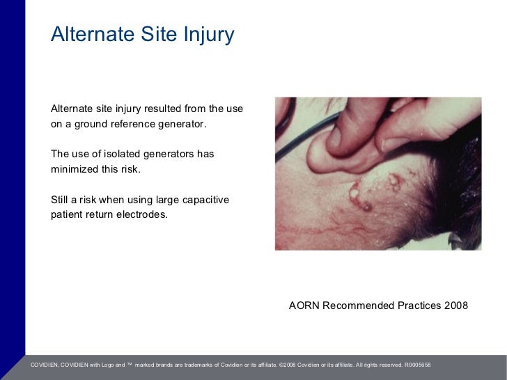 Electrosurgery Saftey