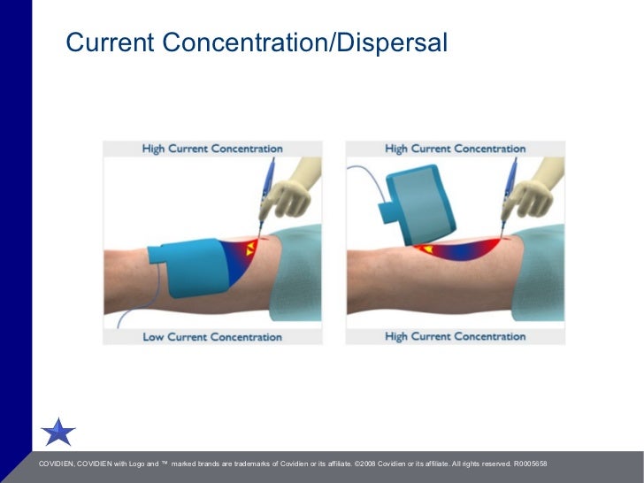 Electrosurgery Saftey
