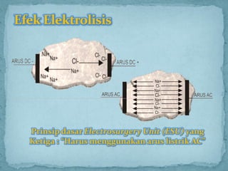 Prinsip dasar Electrosurgery Unit (ESU) yang
Ketiga : “Harus menggunakan arus listrik AC”
 