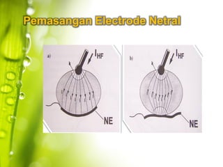 Pemasangan Electrode Netral
 