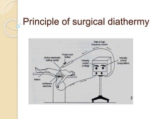 Principle of surgical diathermy 
 