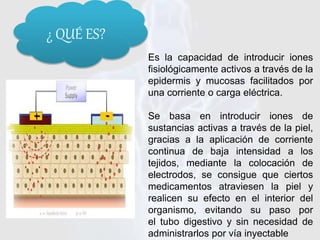Es la capacidad de introducir iones
fisiológicamente activos a través de la
epidermis y mucosas facilitados por
una corriente o carga eléctrica.
Se basa en introducir iones de
sustancias activas a través de la piel,
gracias a la aplicación de corriente
continua de baja intensidad a los
tejidos, mediante la colocación de
electrodos, se consigue que ciertos
medicamentos atraviesen la piel y
realicen su efecto en el interior del
organismo, evitando su paso por
el tubo digestivo y sin necesidad de
administrarlos por vía inyectable
¿ QUÉ ES?
 