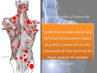 Motor, Gatillo y Puntos de
Acupuntura:
La técnica incluye ubicar una
terminal directamente sobre
el punto, y cerrar el circuito
colocando el otro terminal en
algún área en el costado
afectado.
 