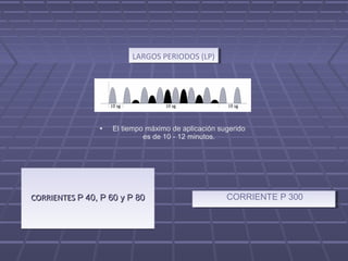 CORRIENTES CORRIENTES P 40, P 60 y P 80P 40, P 60 y P 80CORRIENTES CORRIENTES P 40, P 60 y P 80P 40, P 60 y P 80
 
 CORRIENTE P 300
 
 CORRIENTE P 300
LARGOS PERIODOS (LP)LARGOS PERIODOS (LP)
• El tiempo máximo de aplicación sugerido
es de 10 - 12 minutos.
 