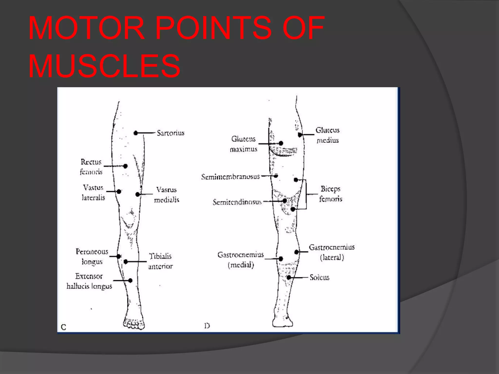 MOTOR POINTS OF
MUSCLES
 