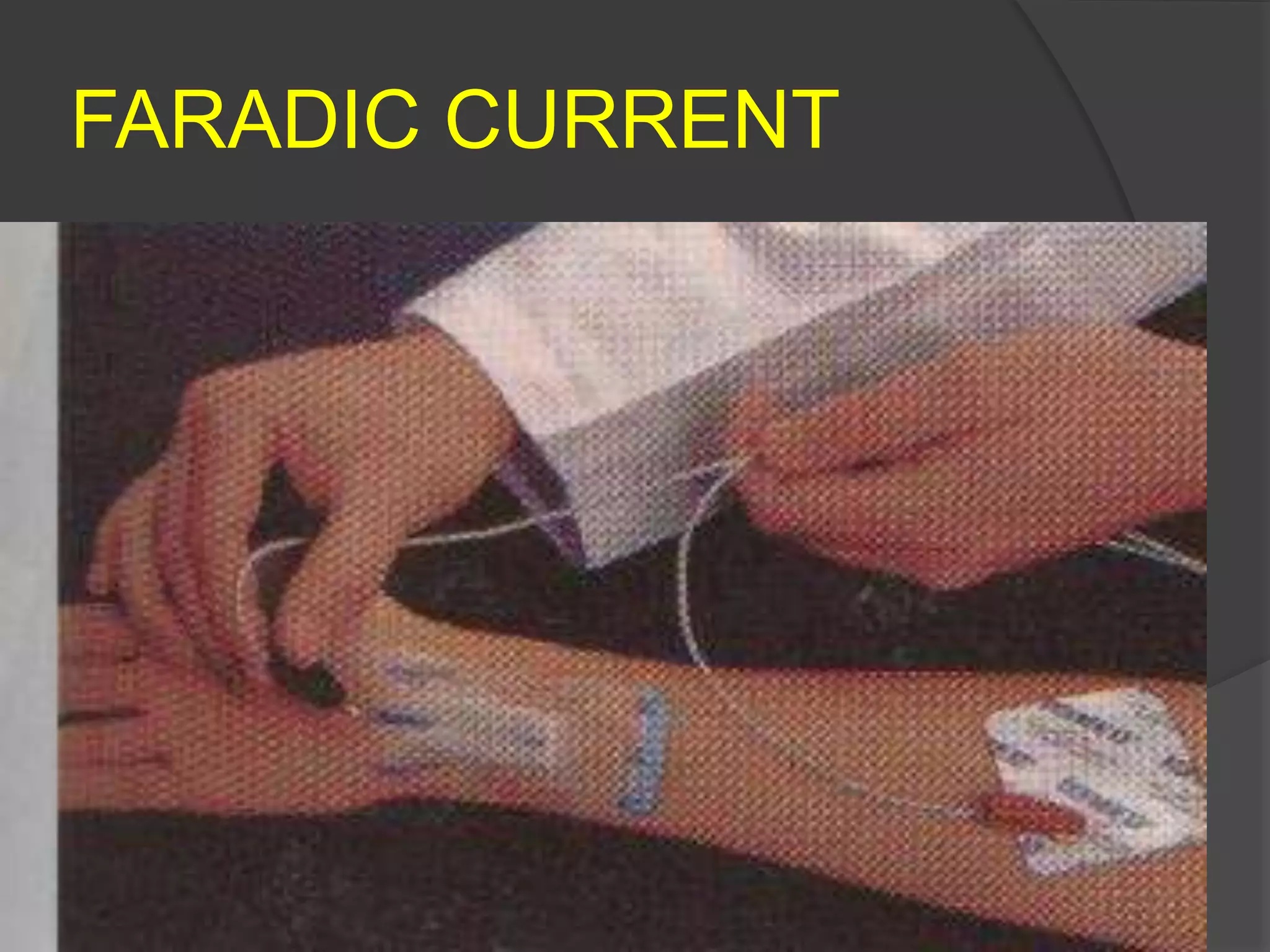 FARADIC CURRENT
 