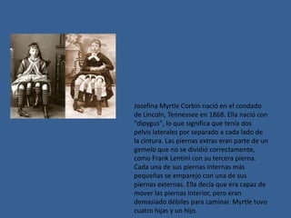 Josefina Myrtle Corbin nació en el condado
de Lincoln, Tennessee en 1868. Ella nació con
"dipygus", lo que significa que t...