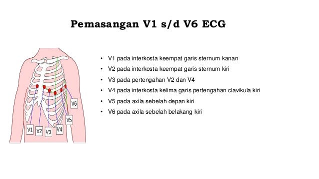 Tentang Elektrocardiografi ECG 