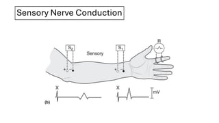 Conduction Test Elektrodiagnosis Nerve Conduction Test & Electromyograph.pdf