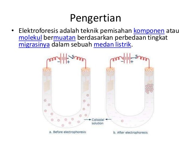 Elektroforesis gel