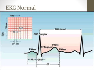 EKG Normal
 