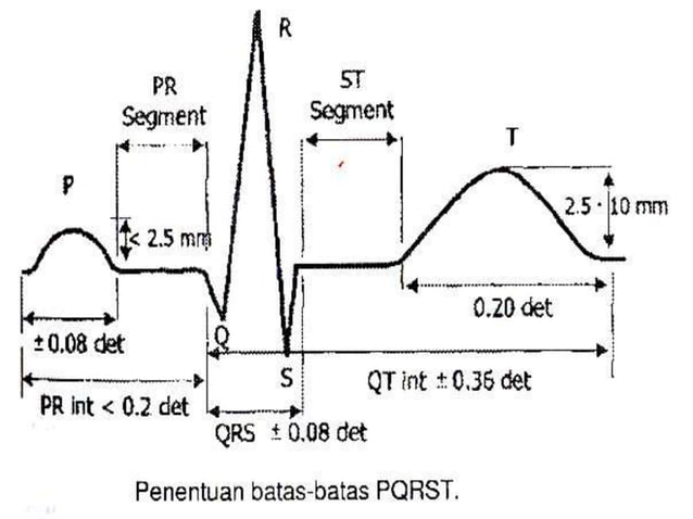 Ekg Rst ELEKTROKARDIOGRAFI.pptx