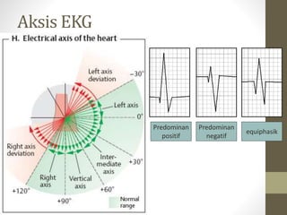 Aksis EKG
Predominan
positif
Predominan
negatif
equiphasik
 