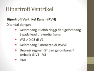 Hipertrofi Ventrikel
Hipertrofi Ventrikel Kanan (RVH)
Ditandai dengan :
 Gelombang R lebih tinggi dari gelombang
S pada lead prekordial kanan
 VAT > 0,03 di V1
 Gelombang S menetap di V5/V6
 Depresi segmen ST dan gelombang T
terbalik di V1 - V3
 RAD
 