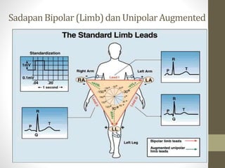 SadapanBipolar (Limb)dan UnipolarAugmented
 