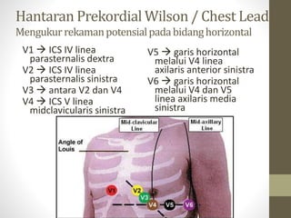 Hantaran Prekordial Wilson / Chest Lead
Mengukurrekamanpotensialpadabidanghorizontal
V1  ICS IV linea
parasternalis dextra
V2  ICS IV linea
parasternalis sinistra
V3  antara V2 dan V4
V4  ICS V linea
midclavicularis sinistra
V5  garis horizontal
melalui V4 linea
axilaris anterior sinistra
V6  garis horizontal
melalui V4 dan V5
linea axilaris media
sinistra
 