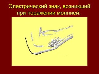 Электрический знак, возникшийЭлектрический знак, возникший
при поражении молнией.при поражении молнией.
 