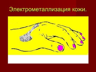 Электрометаллизация кожи.Электрометаллизация кожи.
 