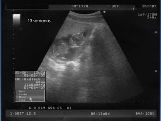 13 semanas
 