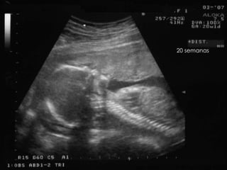 20 semanas
 