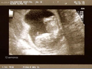 12 semanas
 