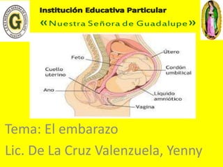 Tema: El embarazo 
Lic. De La Cruz Valenzuela, Yenny 
 