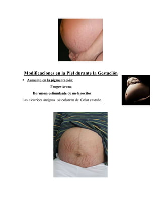 Modificaciones en la Piel durante la Gestación
 Aumento en la pigmentación:
Progesterona
Hormona estimulante de melanocitos
Las cicatrices antiguas se colorean de Color castaño.
 