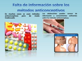En muchos casos se usan métodos
anticonceptivos pero de modo
inadecuado.
Los adolescentes pueden carecer de
información y conocimientos suficientes
sobre los métodos anticonceptivos
 