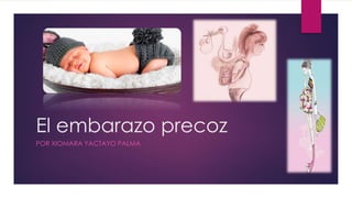 El embarazo precoz
POR XIOMARA YACTAYO PALMA
 