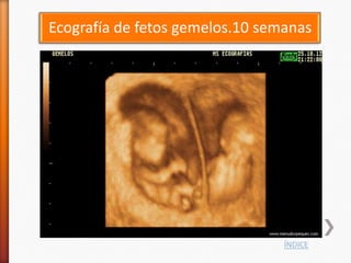 Ecografía de fetos gemelos.10 semanas




                                 ÍNDICE
 