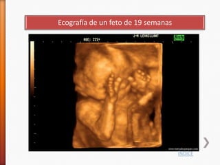 Ecografía de un feto de 19 semanas




                                     ÍNDICE
 