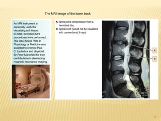 30
The MRI image of the lower back
 