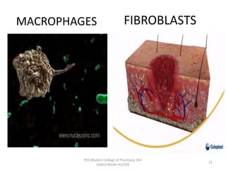MACROPHAGES FIBROBLASTS
PES Modern College of Pharmacy, (for
ladies) Moshi-412105
21
 