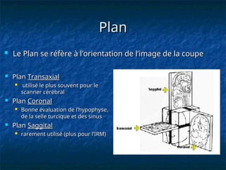 Plan
Plan
 Plan
Plan Transaxial
Transaxial
 utilisé le plus souvent pour le
utilisé le plus souvent pour le
scanner cérébral
scanner cérébral
 Plan
Plan Coronal
Coronal
 Bonne évaluation de l’hypophyse,
Bonne évaluation de l’hypophyse,
de la selle turcique et des sinus
de la selle turcique et des sinus
 Plan
Plan Saggital
Saggital
 rarement utilisé (plus pour l’IRM)
rarement utilisé (plus pour l’IRM)
 Le Plan se réfère à l’orientation de l’image de la coupe
Le Plan se réfère à l’orientation de l’image de la coupe
 