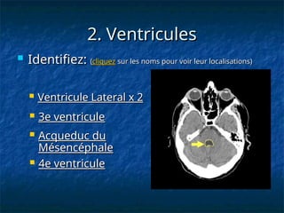 2. Ventricules
2. Ventricules
 3e ventricule
3e ventricule
 4e ventricule
4e ventricule
 Identifiez:
Identifiez: (
(cliquez
cliquez sur les noms pour voir leur localisations)
sur les noms pour voir leur localisations)
 Ventricule Lateral x 2
Ventricule Lateral x 2
 Acqueduc du
Acqueduc du
Mésencéphale
Mésencéphale
 