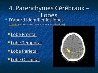 4. Parenchymes Cérébraux –
4. Parenchymes Cérébraux –
Lobes
Lobes
 D’abord identifier les lobes:
D’abord identifier les lobes:
(
(cliquez
cliquez sur les noms pour voir leur localisations)
sur les noms pour voir leur localisations)
 Lobe Temporal
Lobe Temporal
 Lobe Occipital
Lobe Occipital
 Lobe Frontal
Lobe Frontal
 Lobe Parietal
Lobe Parietal
 