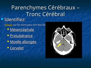 Parenchymes Cérébraux –
Parenchymes Cérébraux –
Tronc Cérébral
Tronc Cérébral
 Identifiez:
Identifiez:
(
(cliquez
cliquez sur les noms pour voir leur localisations)
sur les noms pour voir leur localisations)
 Protubérance
Protubérance
 Cervelet
Cervelet
 Mésencéphale
Mésencéphale
 Moelle allongée
Moelle allongée
 